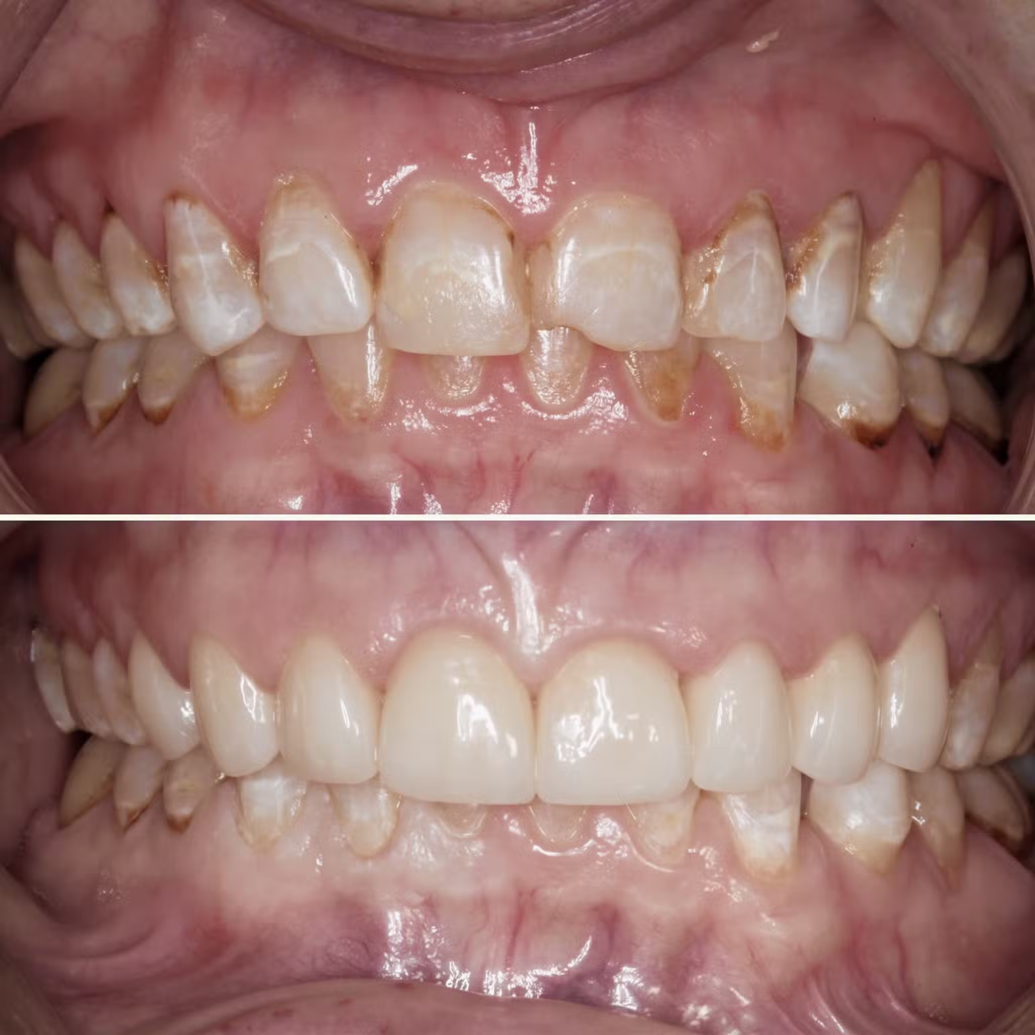Cosmetic Rejuvenation