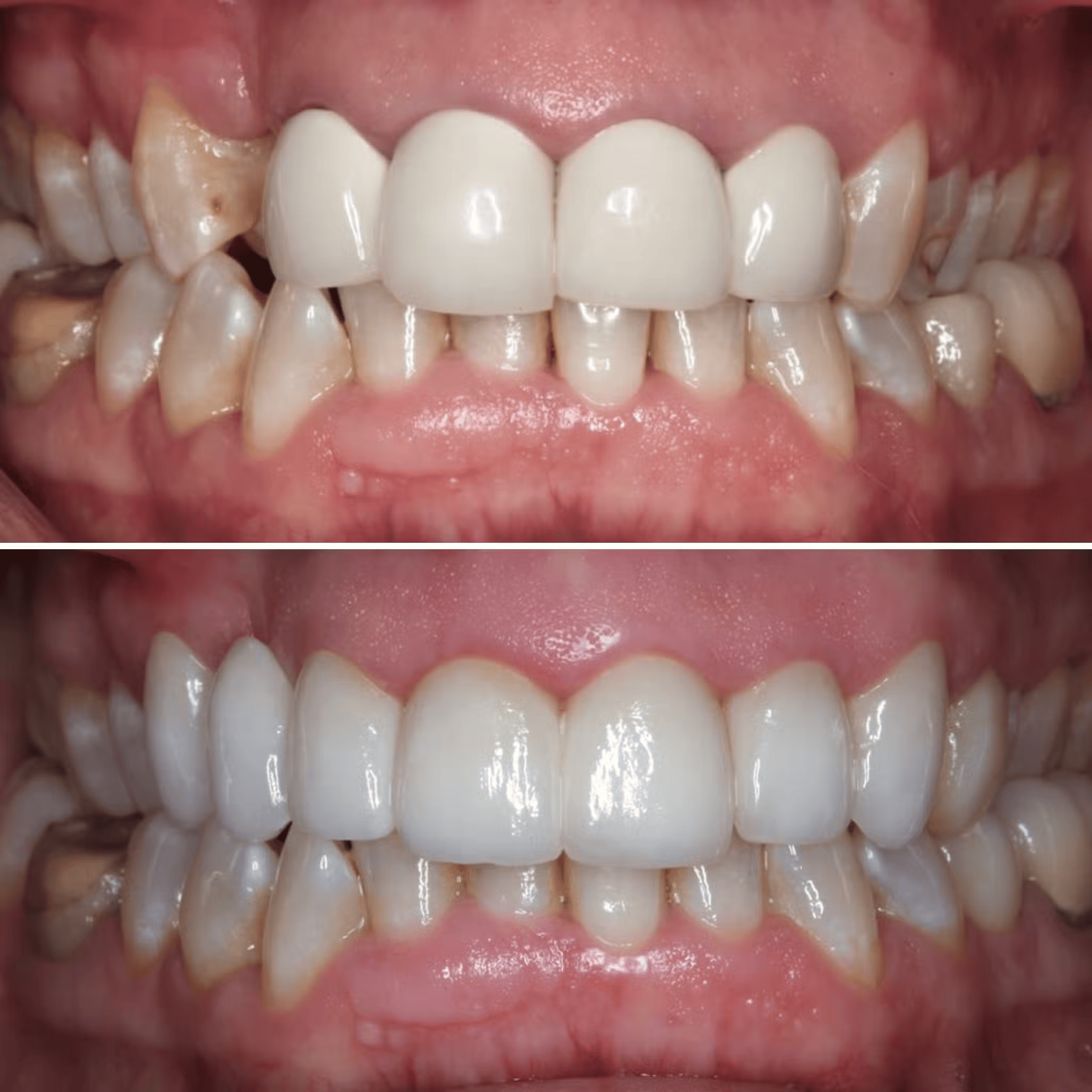 Cosmetic Rejuvenation